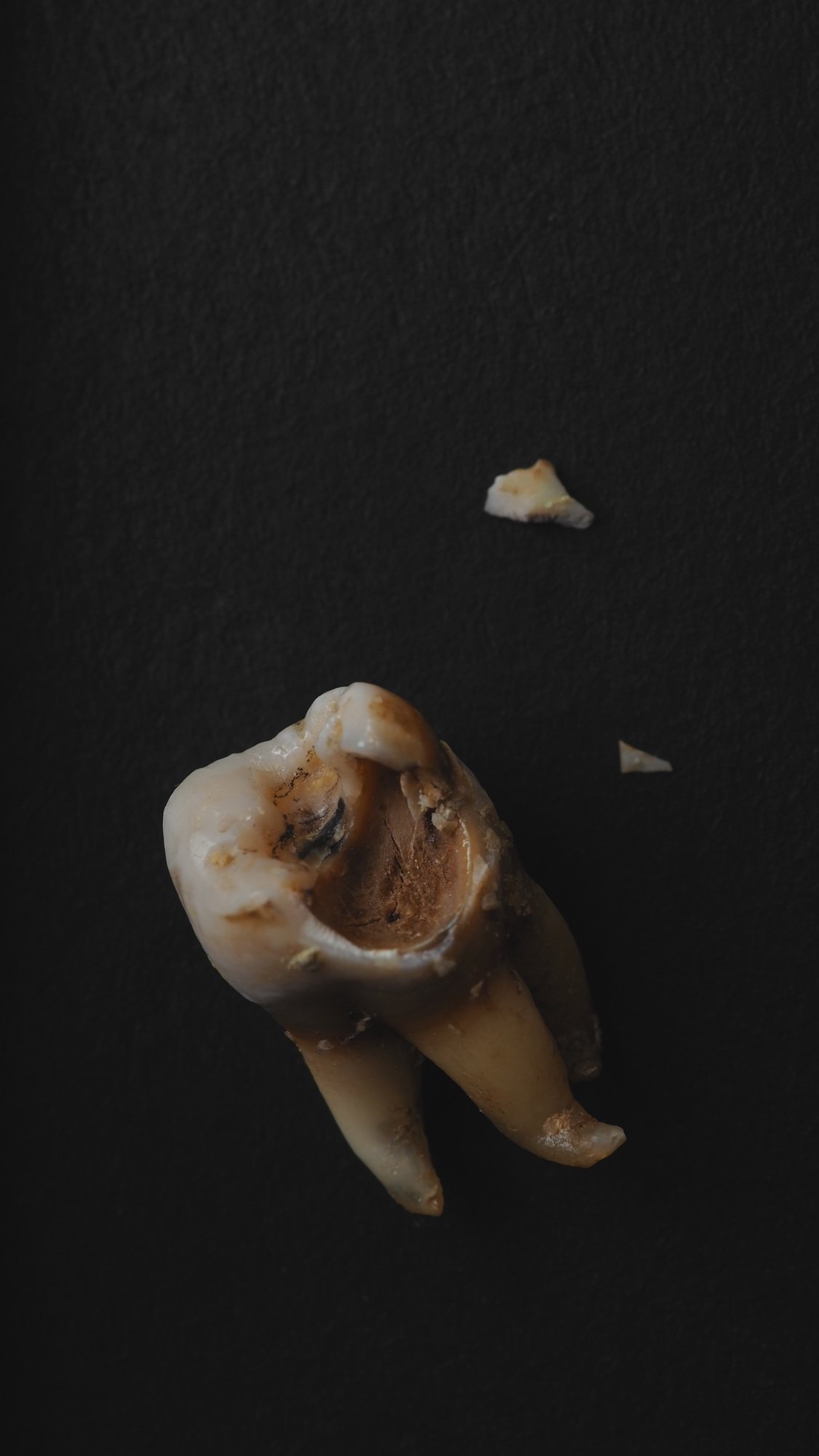 Macro shot of a decayed teeth till root after extraction of dentist.