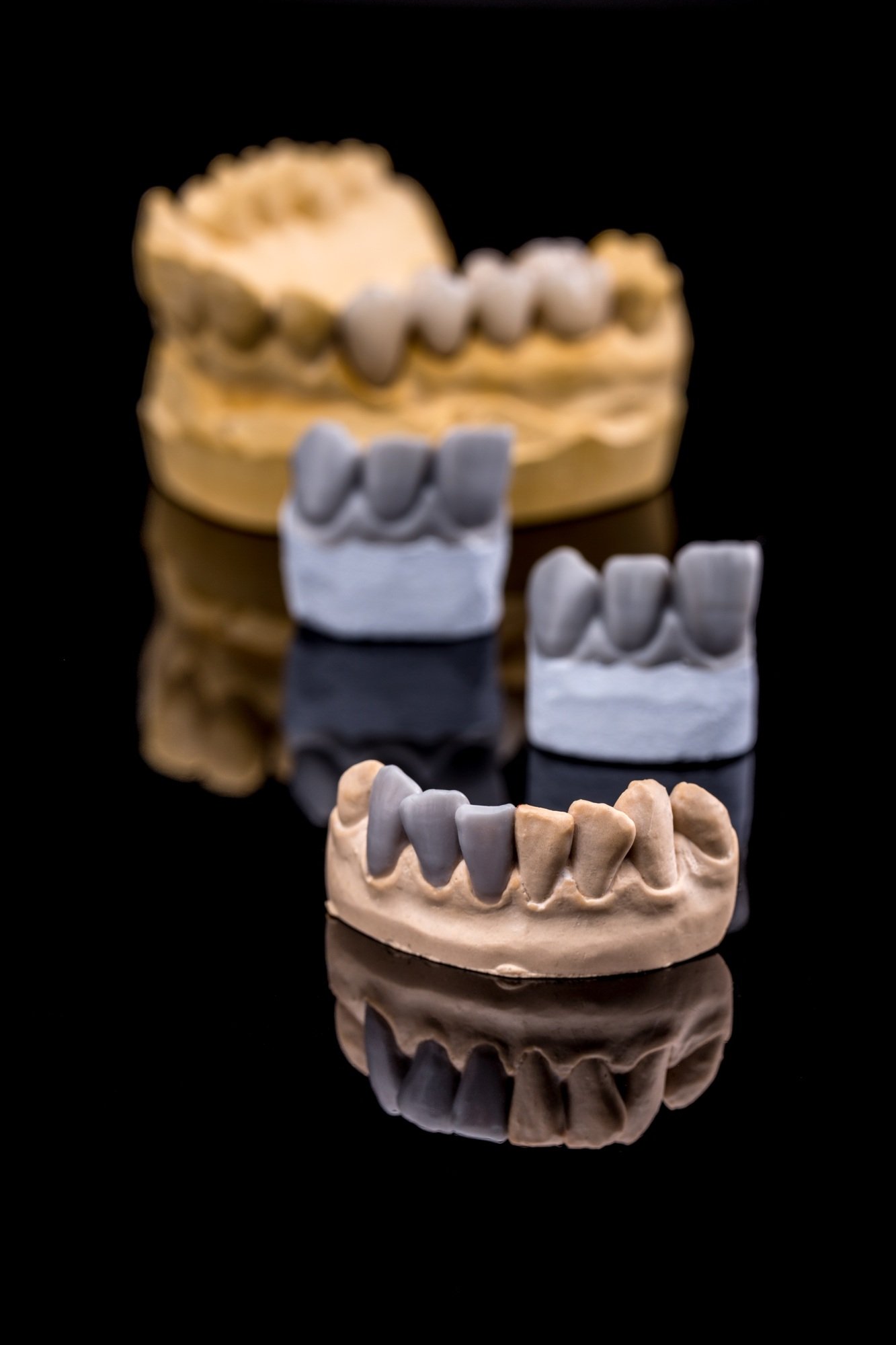 Set of dentures